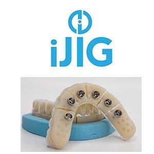 iJIG full arch implant