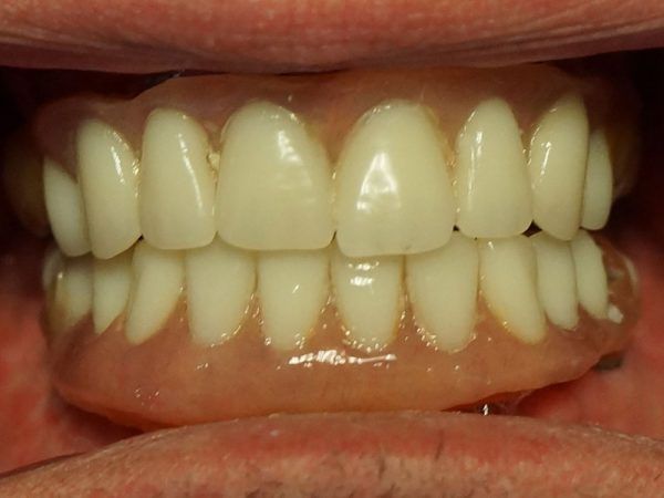 Dental Photogrammetry