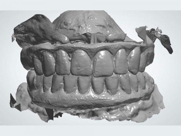 Dental Photogrammetry