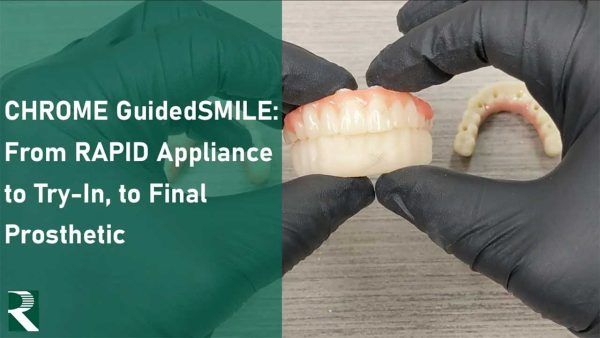 CHROME GuidedSMILE Prosthesis Workflow: From RAPID Appliance to Try-In, to Final Prosthetic