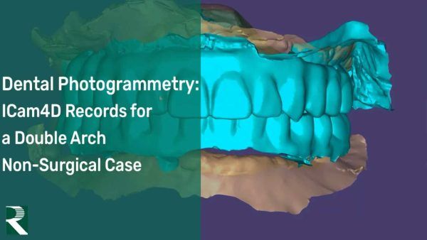 Dental Photogrammetry: ICam4D Records for a Double Arch Non-Surgical Case