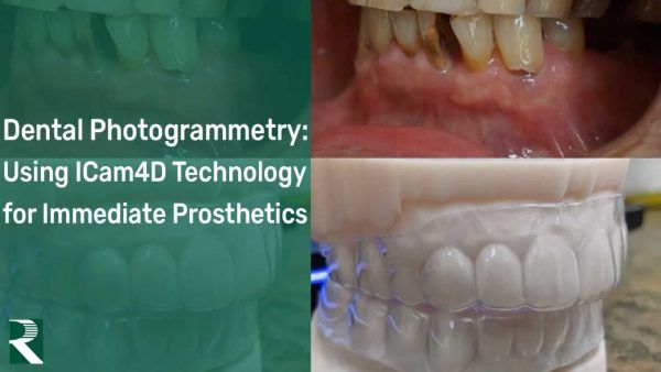 Dental Photogrammetry: Using ICam4D Technology for Immediate Prosthetics