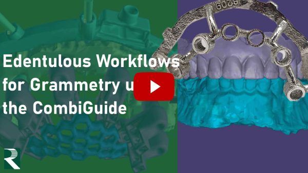 Edentulous Workflows for Grammetry using the CombiGuide