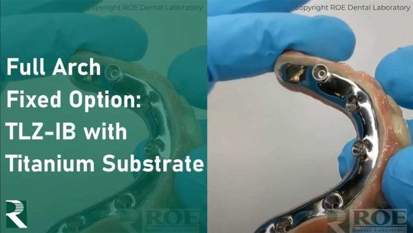 Full Arch Fixed Option: TLZ-IB with Titanium substrate
