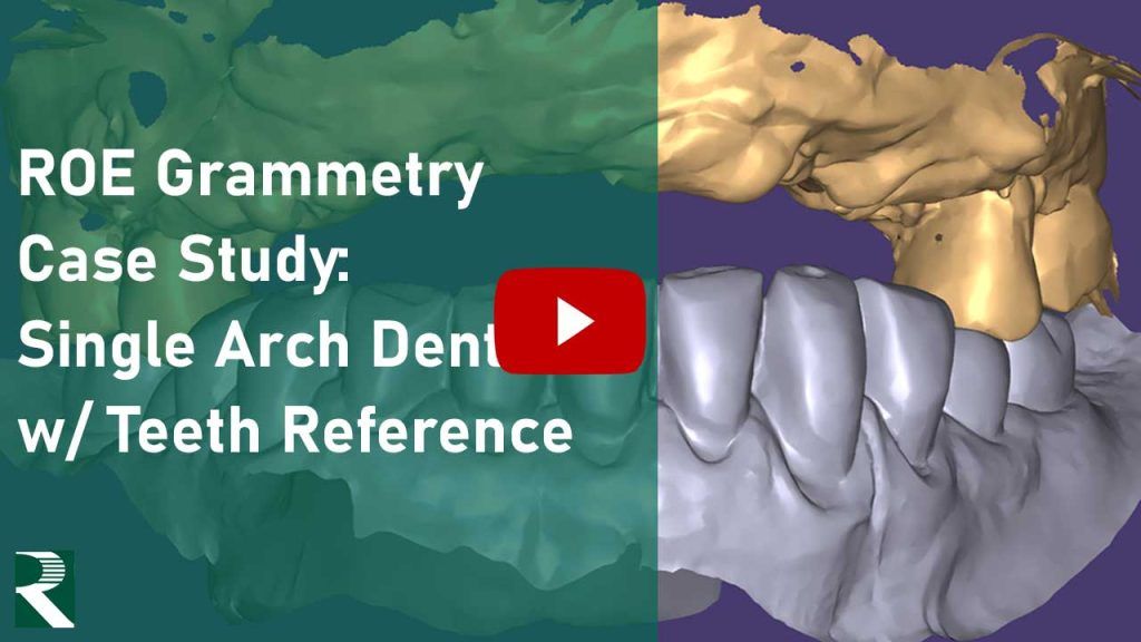 Grammetry Case Study: Single Arch Dentate with Teeth Reference
