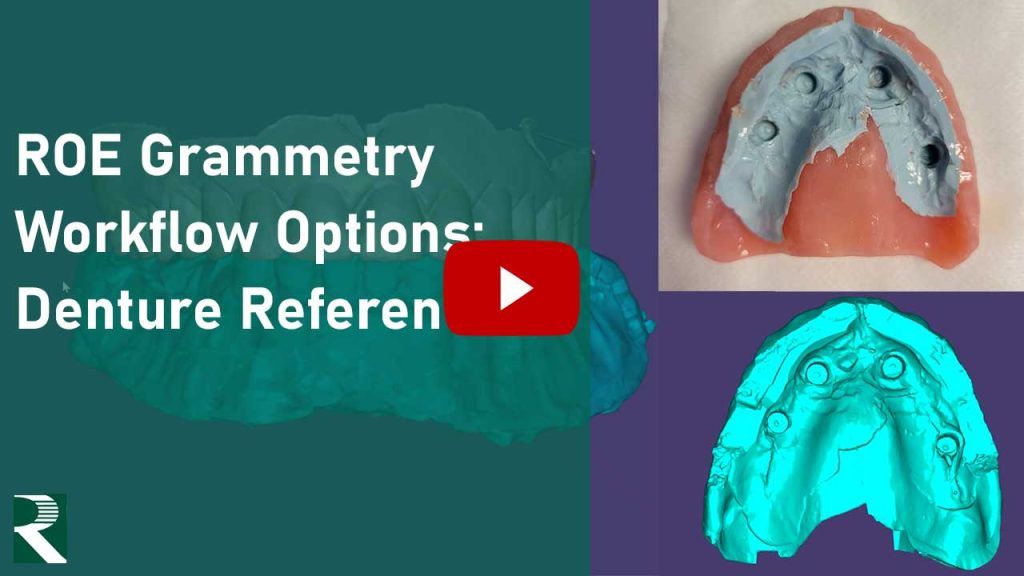 Grammetry Workflow Options: Denture Reference