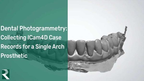 ICam4D Collecting Records for a Single Arch Prosthetic
