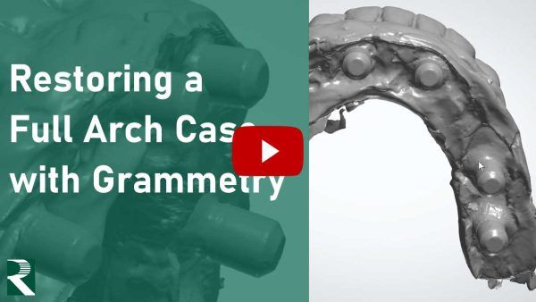 Restoring a Full Arch Case with Grammetry
