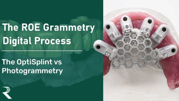 The ROE Grammetry Digital Process - OptiSplint vs Photogrammetry