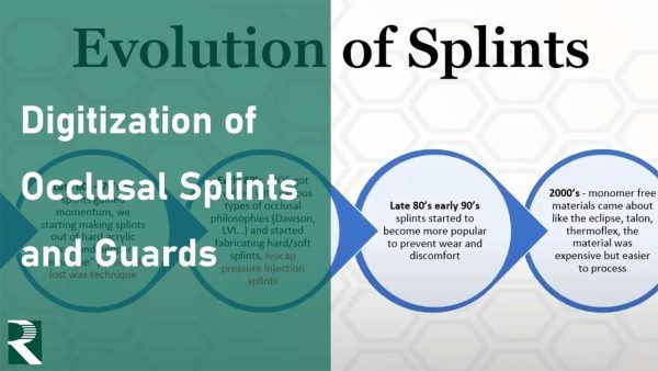 The Digitization of Occlusal Splints and Guards