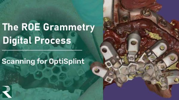 The ROE Grammetry Digital Process - Scanning for OptiSplint