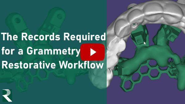 The Records Required for a Grammetry Restorative Workflow