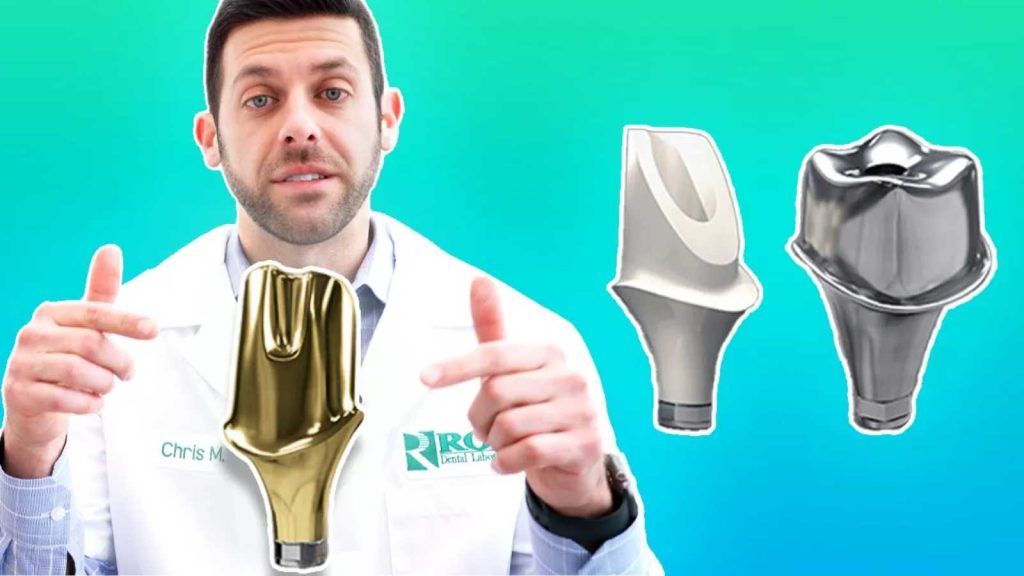 Ti base vs Custom Milled Abutments - The Best Fit for Doctors