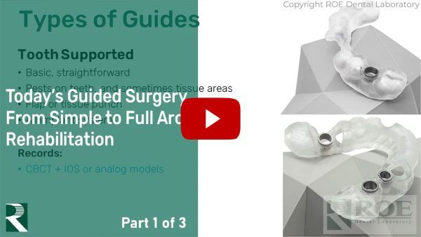 Today's Guided Surgery from Simple to Full Arch Rehabilitation (Part 1 of 3)