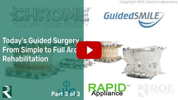 Today's Guided Surgery from Simple to Full Arch Rehabilitation (Part 3 of 3)