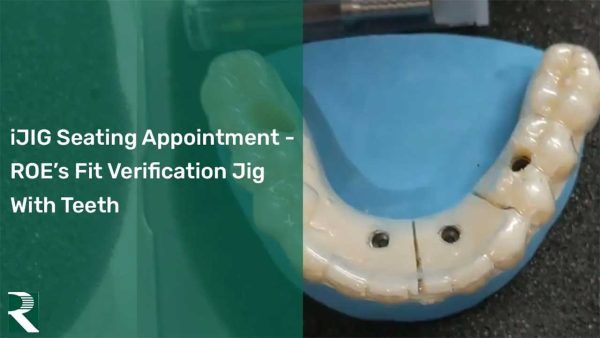 iJIG Seating Appointment - ROE's fit verification jig with teeth