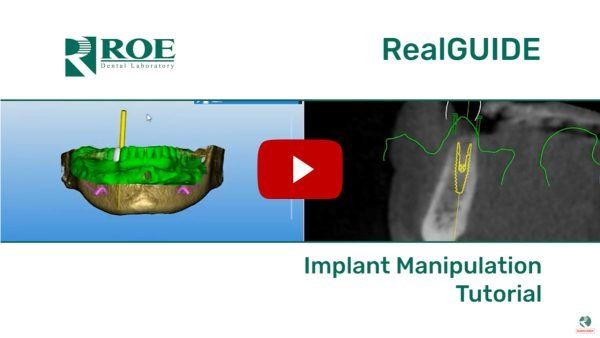 RealGUIDE: Implant Manipulation Tutorial