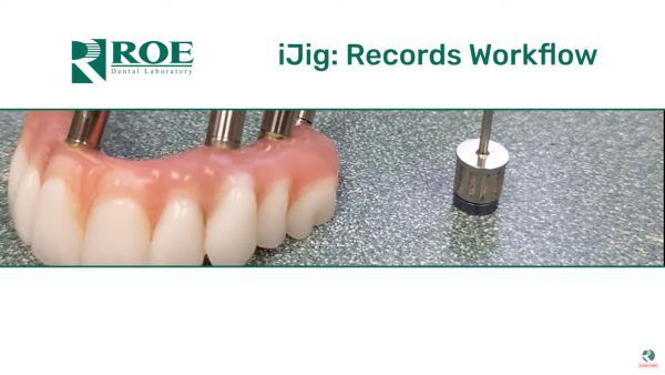 iJig: Records Workflow
